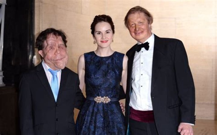 Adam Pearson's Wife: Exploring His Life and Relationships